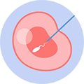 卵泡漿內單精子顯微注射
